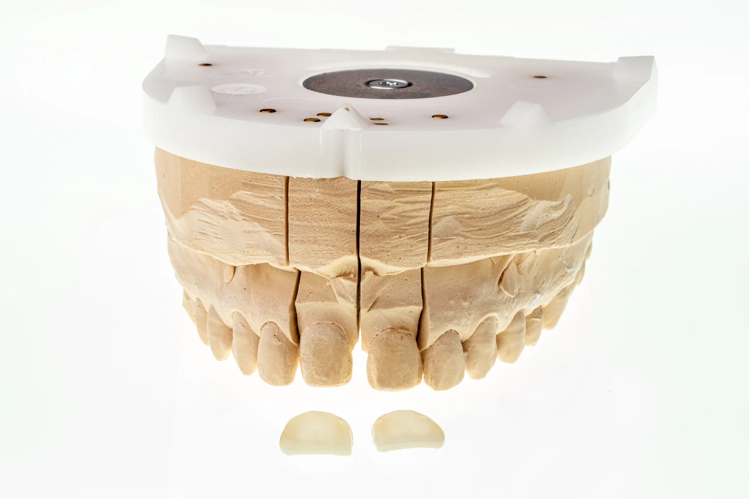 modello di arcata dentale superiore prima dell'applicazione di una faccetta dentale