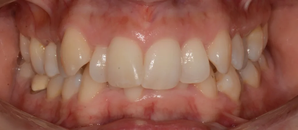 Primissimo piano di una bocca aperta con le arcate dentali originali