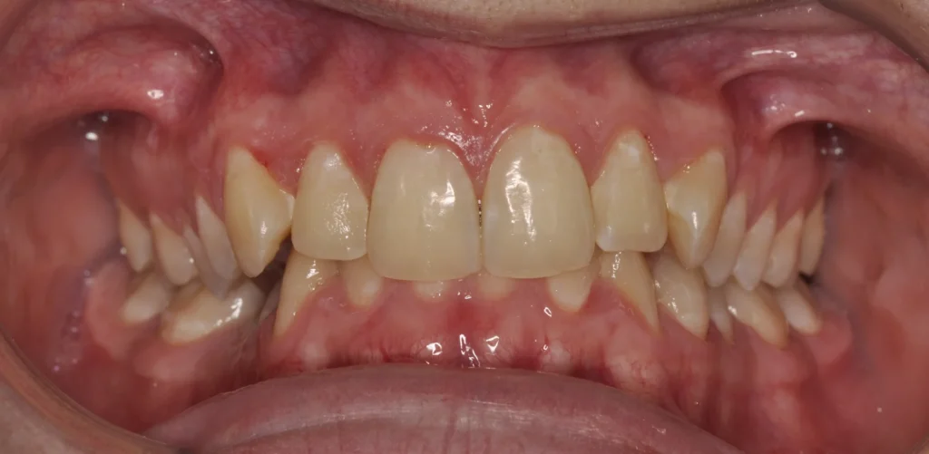 Primissimo piano di una bocca aperta con le arcate dentali originali