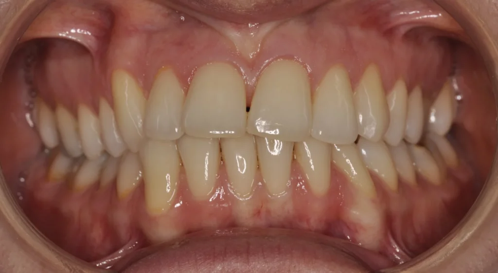 Primissimo piano di una bocca aperta con le arcate dentali originali