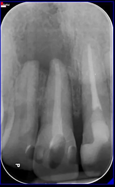 radiografia-endodonzia-01-a